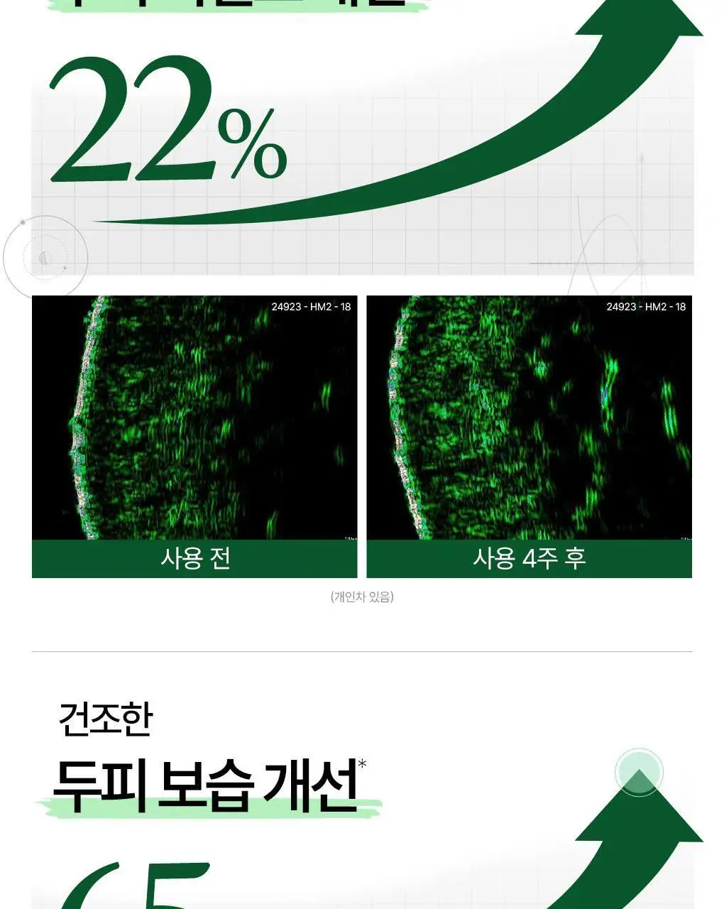 [두피활력&모발강화] 클로란 퀴닌 에델바이스 샴푸 400ml 상세페이지 12